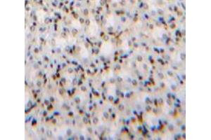IHC-P analysis of Kidney tissue, with DAB staining. (TCF20 anticorps  (AA 1656-1792))