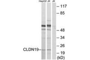 Western blot analysis of extracts from Jurkat/HepG2 cells, using CLDN19 Antibody. (Claudin 19 anticorps  (AA 81-130))