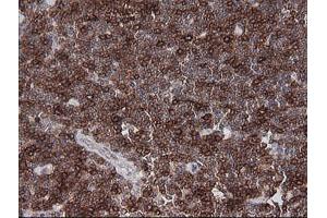 Immunohistochemistry (IHC) image for anti-T-cell surface glycoprotein CD1c (CD1C) antibody (ABIN2670660) (CD1c anticorps)