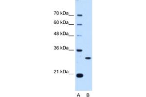 Western Blotting (WB) image for anti-PSME3 (PSME3) antibody (ABIN2462948) (PSME3 anticorps)
