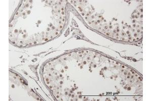 Immunoperoxidase of purified MaxPab antibody to ING4 on formalin-fixed paraffin-embedded human testis.