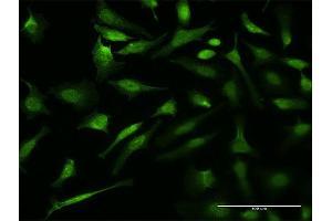 Immunofluorescence of monoclonal antibody to VCP on HeLa cell.