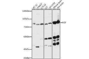 Western blot analysis of extracts of various cell lines, using NSF antibody (ABIN6130571, ABIN6144871, ABIN6144872 and ABIN6214029) at 1:3000 dilution. (NSF anticorps  (AA 1-250))