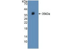 Detection of Recombinant JAK2, Human using Polyclonal Antibody to Janus Kinase 2 (JAK2) (JAK2 anticorps  (AA 508-800))