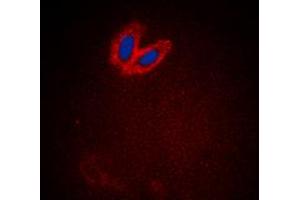 Immunofluorescent analysis of ACK1 (pY284) staining in HeLa cells. (TNK2 anticorps  (pTyr284))
