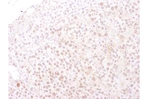 Immunohistochemistry (IHC) image for anti-Minichromosome Maintenance Deficient 4 (MCM4) (AA 325-375) antibody (ABIN7449391) (MCM4 anticorps  (AA 325-375))