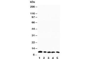 Western blot testing of MIP-1 beta antibody and mouse samples:  1. (CCL4 anticorps  (AA 74-88))