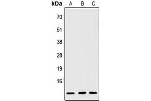 Western blot analysis of IGFL2 expression in Jurkat (A), NIH3T3 (B), H9C2 (C) whole cell lysates. (IGFL2 anticorps  (Center))