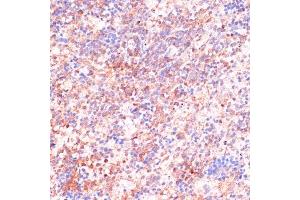 Immunohistochemistry of paraffin-embedded Rat spleen using CDC20 antibody (ABIN7266246) at dilution of 1:100 (40x lens).