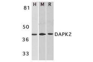 Western blot analysis of DAPK2 in A431 (H), mouse spleen (M), and rat kidney (R) lysates with DAPK2 antibody at 1μg/ml. (DAPK2 anticorps  (AA 356-370))