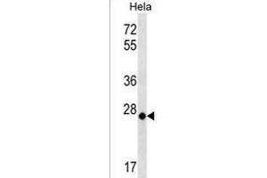 MT-CO3 Antibody (N-term) (ABIN1539412 and ABIN2838144) western blot analysis in Hela cell line lysates (35 μg/lane). (COX3 anticorps  (N-Term))