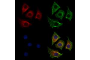 ABIN7094293 and ABIN7098340 staining HepG2 cells by IF/ICC. (HTRA1 anticorps  (Internal Region))