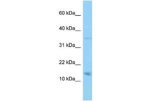 WB Suggested Anti-PMP22 Antibody Titration: 1. (PMP22 anticorps  (N-Term))