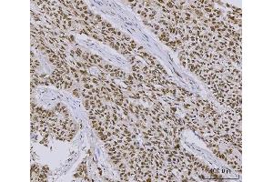 IHC analysis of PC4/SUB1 using anti-PC4/SUB1 antibody (ABIN7602185). (SUB1 anticorps  (AA 62-127))