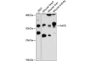 Western blot analysis of extracts of various cell lines, using N antibody (ABIN6132387, ABIN6144378, ABIN6144379 and ABIN6216511) at 1:3000 dilution. (NAT2 anticorps  (AA 171-290))
