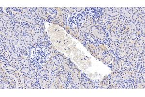 Detection of GPC4 in Human Kidney Tissue using Polyclonal Antibody to Glypican 4 (GPC4) (GPC4 anticorps  (AA 261-527))