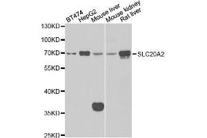 Western blot analysis of extracts of various cell lines, using SLC20A2 antibody.