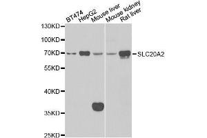 Western blot analysis of extracts of various cell lines, using SLC20A2 antibody. (SLC20A2 anticorps  (AA 235-485))
