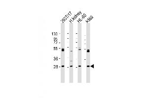 Western Blot at 1:2000 dilution Lane 1: 293T/17 whole cell lysate Lane 2: human kidney lysate Lane 3: HL-60 whole cell lysate Lane 4: K562 whole cell lysate Lysates/proteins at 20 ug per lane. (ARV1 anticorps  (N-Term))
