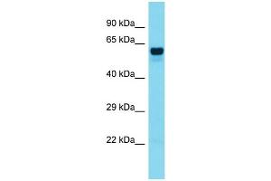 Host:  Rabbit  Target Name:  FOXO6  Sample Type:  Colorectal Tumor lysates  Antibody Dilution:  1. (Foxo6 anticorps  (Middle Region))