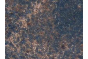 Detection of TUBd in Rat Spleen Tissue using Polyclonal Antibody to Tubulin Delta (TUBd)