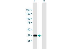 anti-Nuclear Receptor Binding Factor 2 (NRBF2) (AA 1-287) antibody