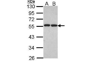 WB Image Sample (30 ug of whole cell lysate) A: H1299 B: Hela 10% SDS PAGE antibody diluted at 1:1000 (FAF2 anticorps  (C-Term))
