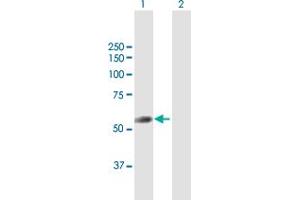 Western Blot analysis of TRIT1 expression in transfected 293T cell line by TRIT1 MaxPab polyclonal antibody. (TRIT1 anticorps  (AA 1-467))