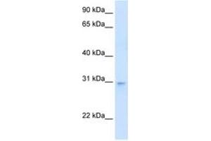 Image no. 1 for anti-LIM Domain Binding 3 (LDB3) (AA 101-150) antibody (ABIN204971) (LIM Domain Binding 3 Protein anticorps  (AA 101-150))