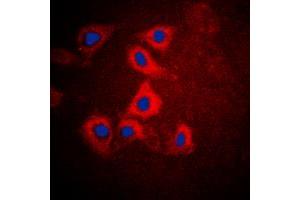 Immunofluorescent analysis of HEXB staining in HepG2 cells. (HEXB anticorps  (C-Term))