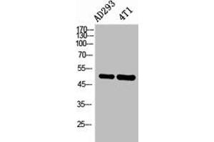 Western Blot analysis of AD293, 4T1 cells using IL-6Rα Polyclonal Antibody. (IL-6 Receptor anticorps  (Internal Region))