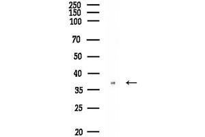 anti-Ring Finger Protein 130 (RNF130) (Internal Region) antibody