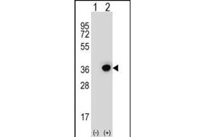 Western blot analysis of DHRS3 (arrow) using rabbit polyclonal DHRS3 Antibody (Center) (ABIN653135 and ABIN2842711).
