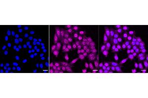 anti-Interleukin-1 Receptor-Associated Kinase 2 (IRAK2) antibody