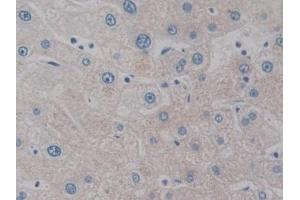 Detection of IL2 in Human Liver Tissue using Monoclonal Antibody to Interleukin 2 (IL2) (IL-2 anticorps  (AA 21-153))