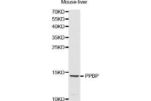 Western Blotting (WB) image for anti-Pro-Platelet Basic Protein (Chemokine (C-X-C Motif) Ligand 7) (PPBP) (AA 31-128) antibody (ABIN1513400) (CXCL7 anticorps  (AA 31-128))