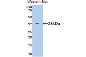 Western blot analysis of the recombinant protein. (LDHB anticorps  (AA 1-334))