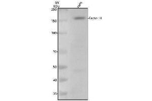 Western blot analysis of Factor H/CFH using anti-Factor H/CFH antibody (ABIN7604809).