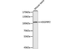 Western blot analysis of extracts of mouse testis, using HDGFRP2 antibody. (HDGFRP2 anticorps)