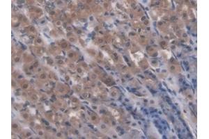 Detection of RIPK1 in Rat Stomach Tissue using Polyclonal Antibody to Receptor Interacting Serine Threonine Kinase 1 (RIPK1)