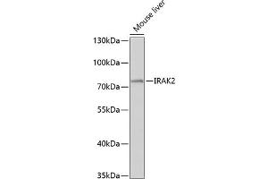 Western blot analysis of extracts of mouse liver, using IR antibody (ABIN3016606, ABIN3016607, ABIN3016608 and ABIN6219797) at 1:1000 dilution. (IRAK2 anticorps  (AA 1-270))