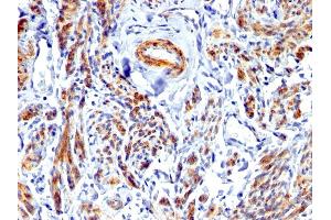 Formalin-fixed, paraffin-embedded human Uterus stained with Caldesmon Rabbit Polyclonal Antibody.