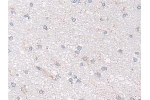 Detection of NDUFS1 in Human Cerebrum Tissue using Polyclonal Antibody to NADH Dehydrogenase Ubiquinone Fe-S Protein 1 (NDUFS1)