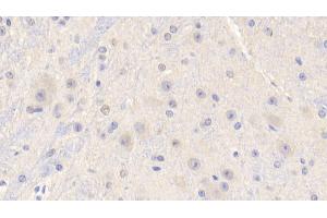 Detection of IGF1 in Mouse Cerebrum Tissue using Polyclonal Antibody to Insulin Like Growth Factor 1 (IGF1) (IGF1 anticorps  (AA 33-102))