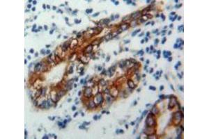 Used in DAB staining on fromalin fixed paraffin-embedded Stomach tissue (CD1d anticorps  (AA 64-298))