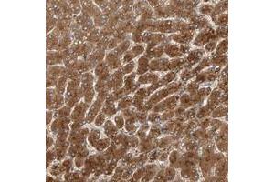 Immunohistochemical staining of human liver with ZNF160 polyclonal antibody  shows strong cytoplasmic positivity in hepatocytes. (ZNF160 anticorps)