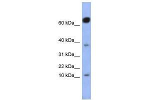 NKX6-3 antibody used at 0. (NK6 Homeobox 3 anticorps  (Middle Region))