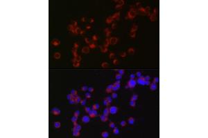 Immunofluorescence analysis of Neuro-2a cells using DCX Rabbit pAb (ABIN3021509, ABIN3021510, ABIN3021511 and ABIN6215166) at dilution of 1:50 (40x lens).