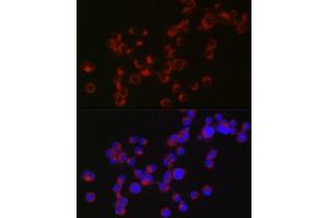 Immunofluorescence analysis of Neuro-2a cells using DCX Rabbit pAb (ABIN3021509, ABIN3021510, ABIN3021511 and ABIN6215166) at dilution of 1:50 (40x lens). (Doublecortin anticorps  (AA 11-360))