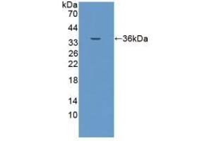 Detection of Recombinant EPCAM, Porcine using Polyclonal Antibody to Epithelial Cell Adhesion Molecule (EPCAM) (EpCAM anticorps  (AA 25-265))